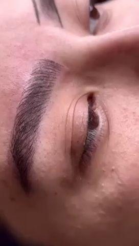 آرایش دایم صورت فیبروز و میکروبلیدینگ ابرو