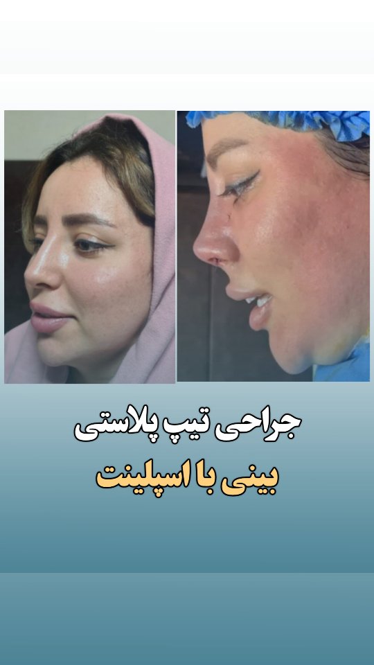 جراح بینی دکتر نادرنظری