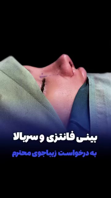 جراح زیبایی و بینی دکتر افشین قاسمی