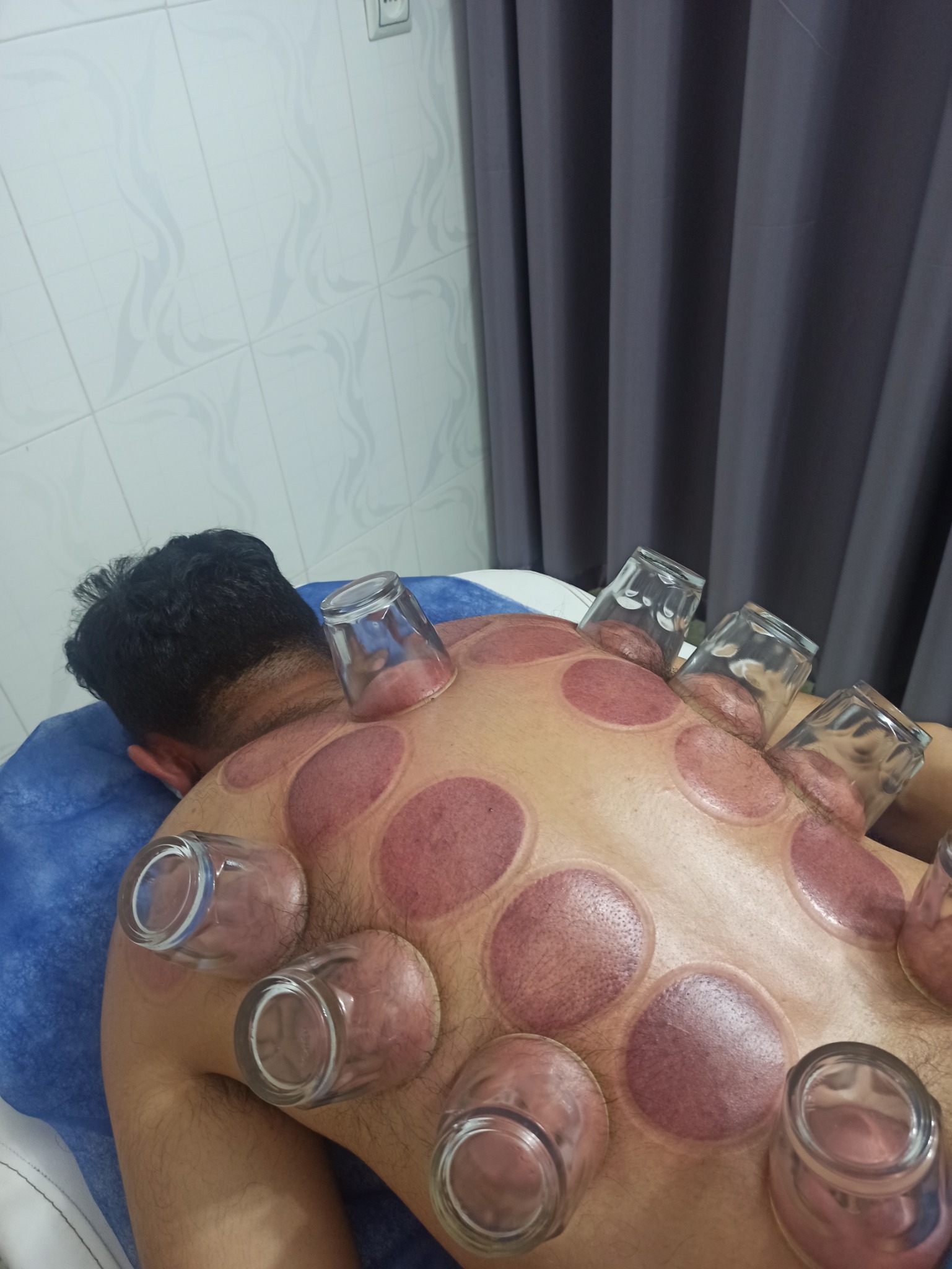 حجامت ماساژ درمانی و ریلکسی زالو درمانی عبدی