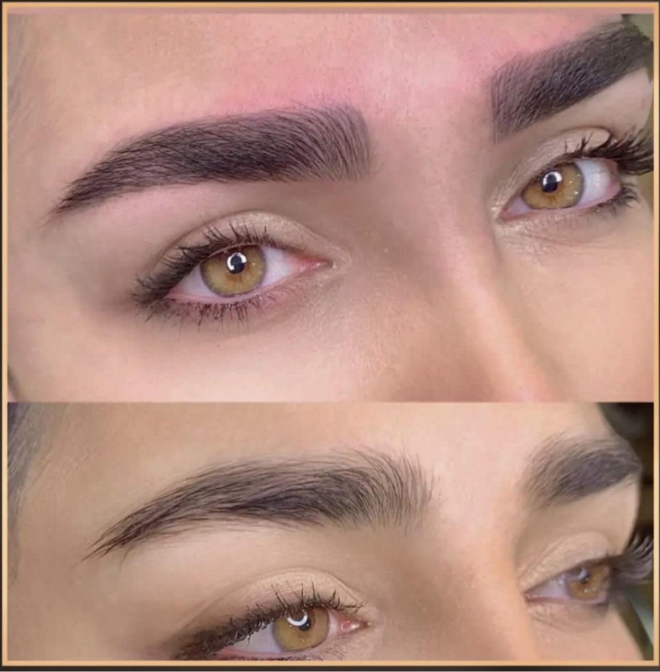 خدمات تخصصی فیبروز و میکروبلیدینگ سحر