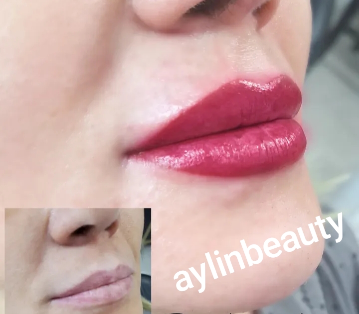 خدمات تخصصی فیشیال صورت مهدیه