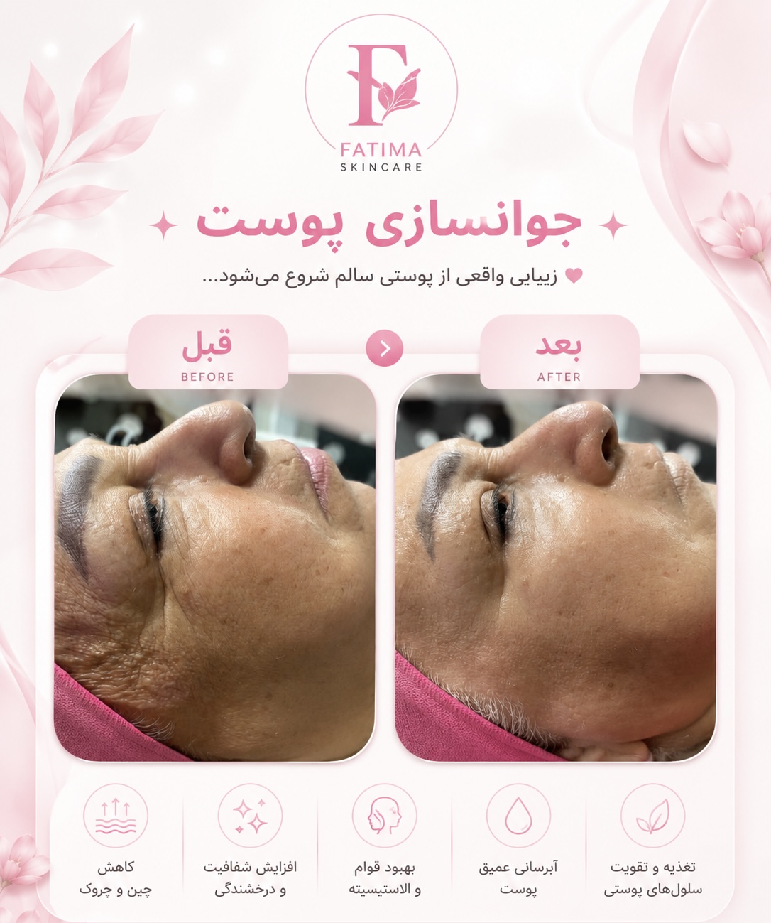 خدمات تخصصی فیشیال و ماساژ فاطمه