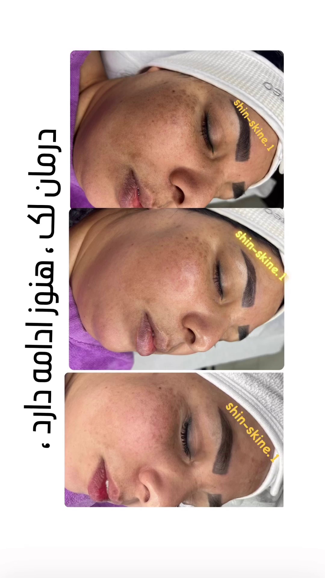 خدمات زیبایی skin_shin.1