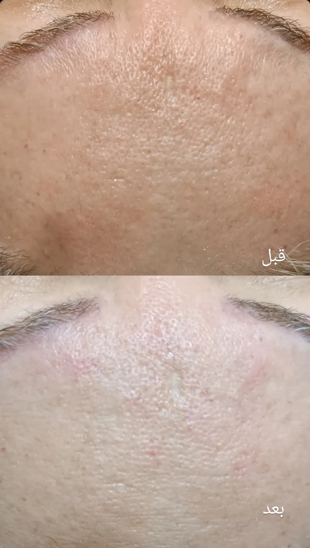 خدمات فیشال و پاکسازی پوست المیرا