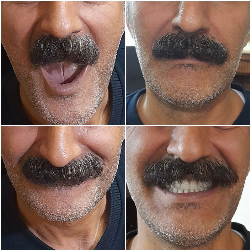 دندانسازی هلنا