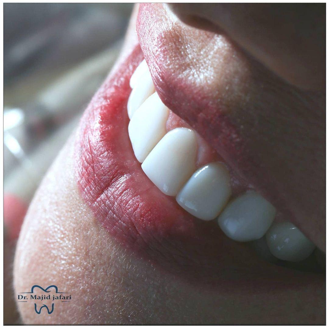 دندانپزشکی دکتر مجید جعفری