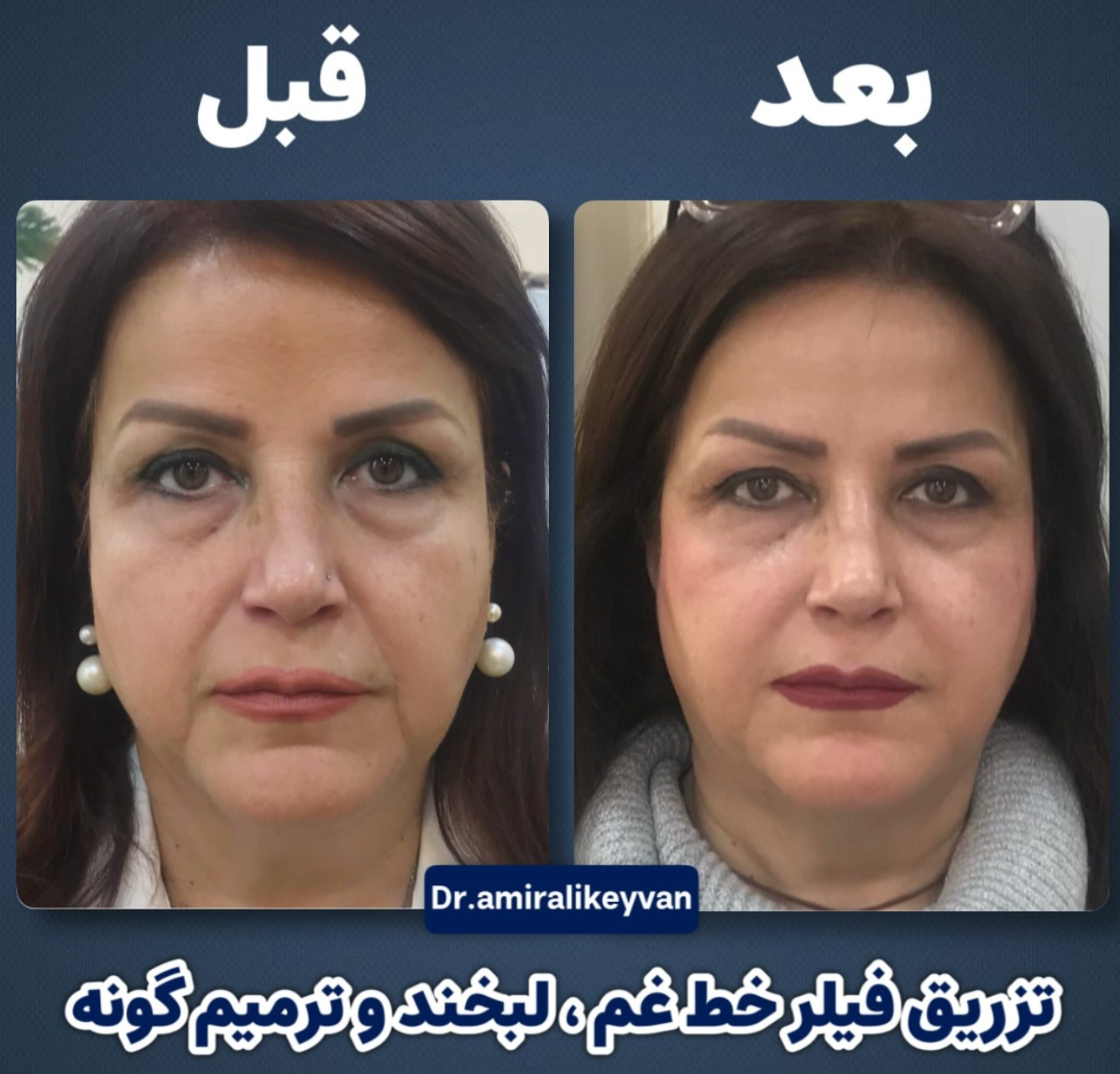 دکتر امیرعلی کیوان