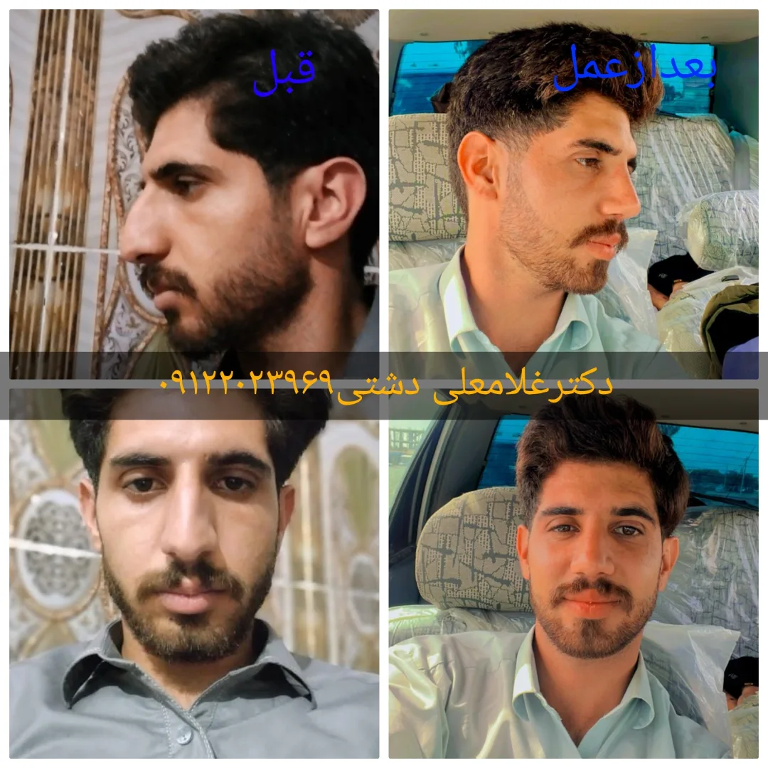 دکتر غلامعلی دشتی خویدکی