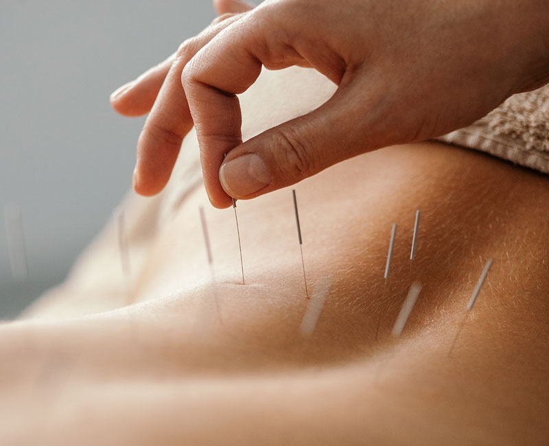 طب سوزنی و سنتی دکتر ملک پور
