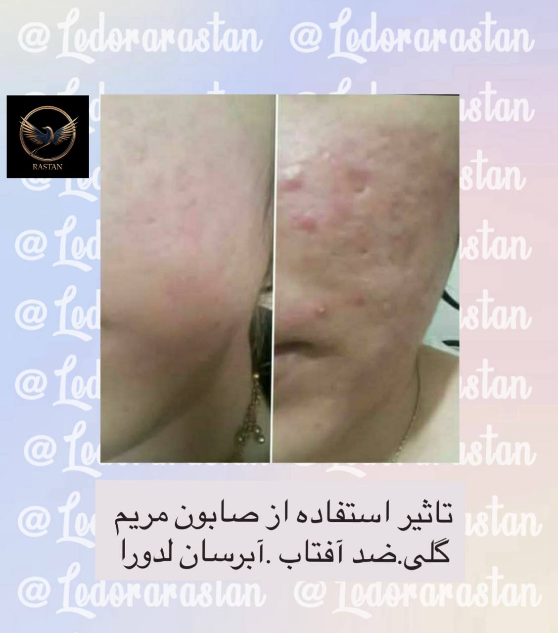 فروش محصولات آرایشی و بهداشتی LDORA