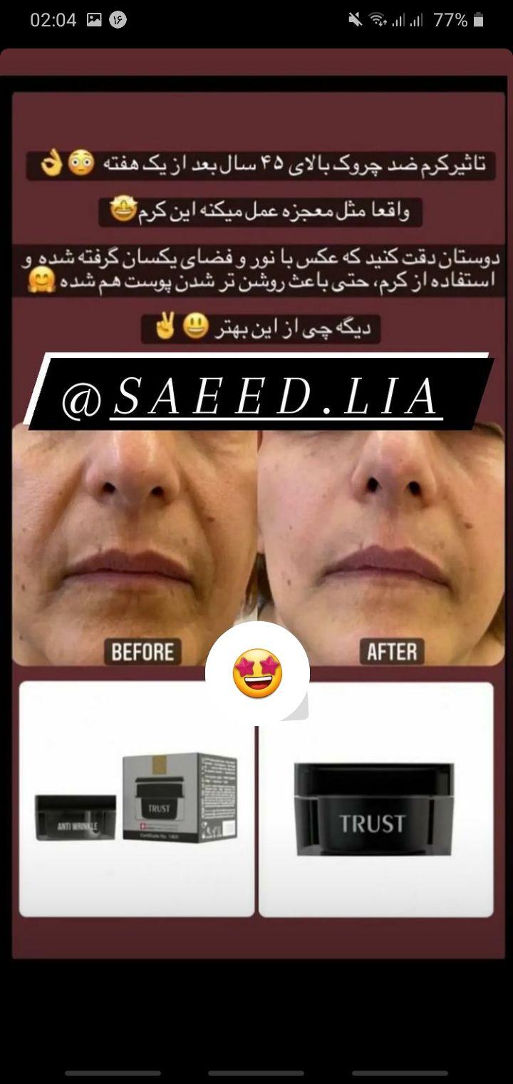 فروش محصولات تخصصی تراست
