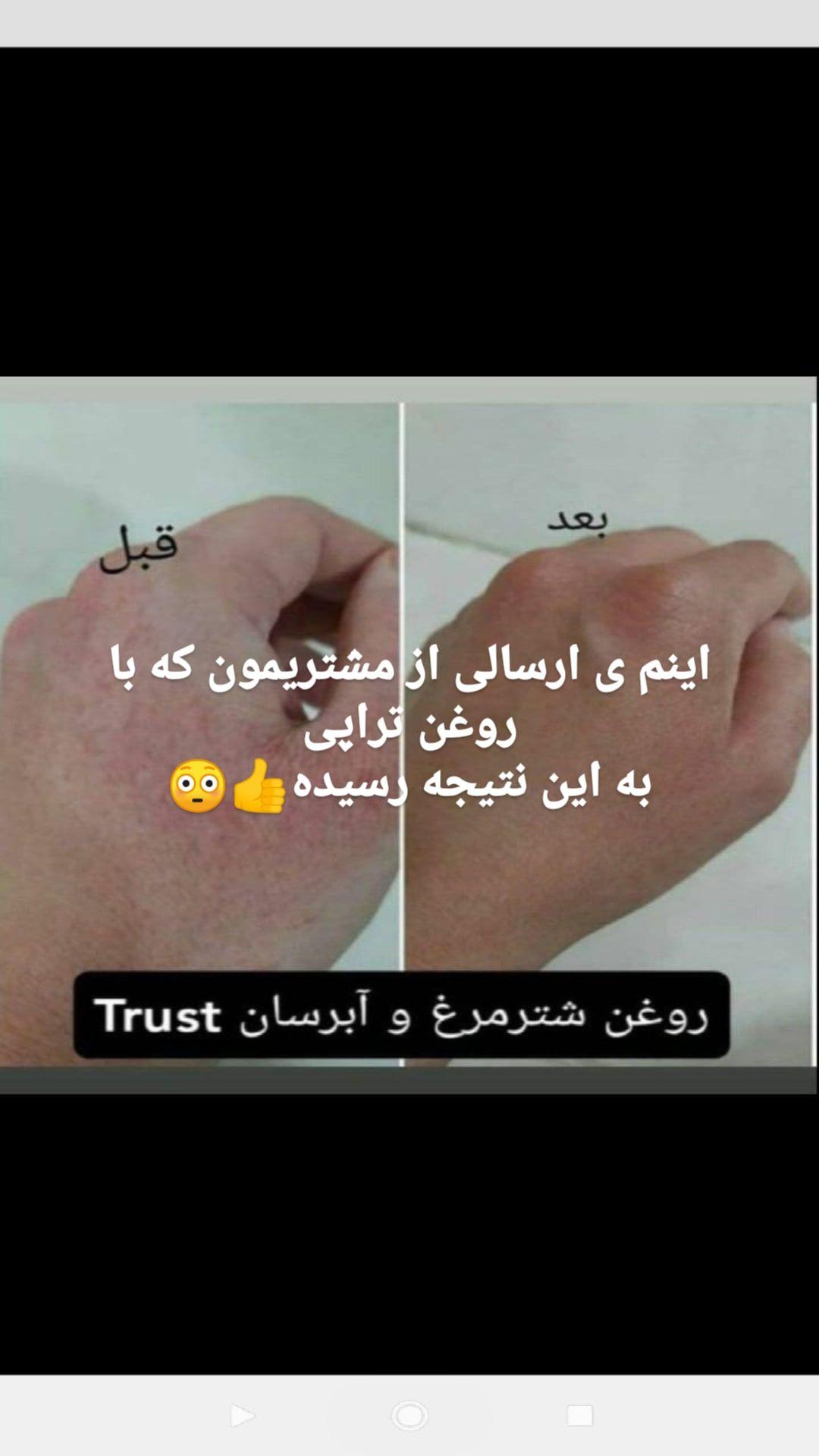 فروش محصولات مراقبتی ارایشی trust