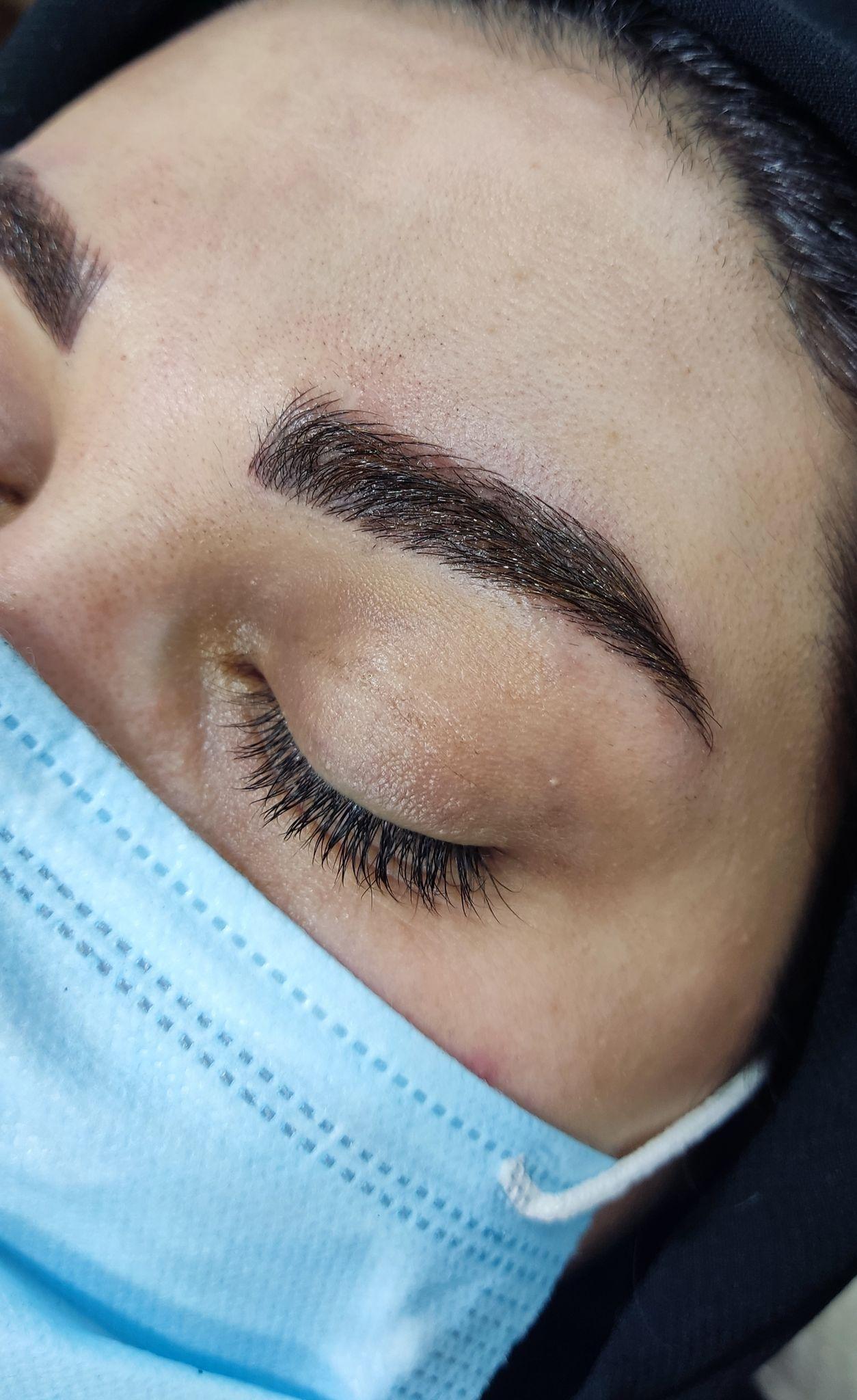 فیبروز ابرو در سوسنگرد