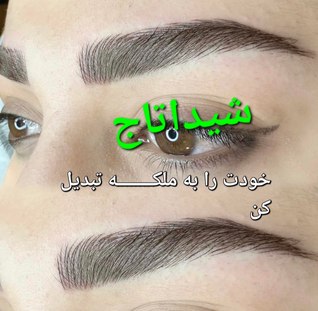 فیبروز ابرو شیدا