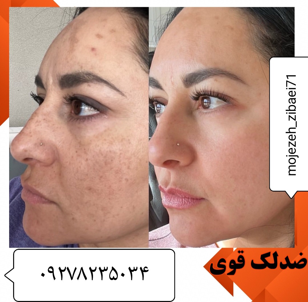 لوازم آرایشی و بهداشتی ندا انلاین شاپ