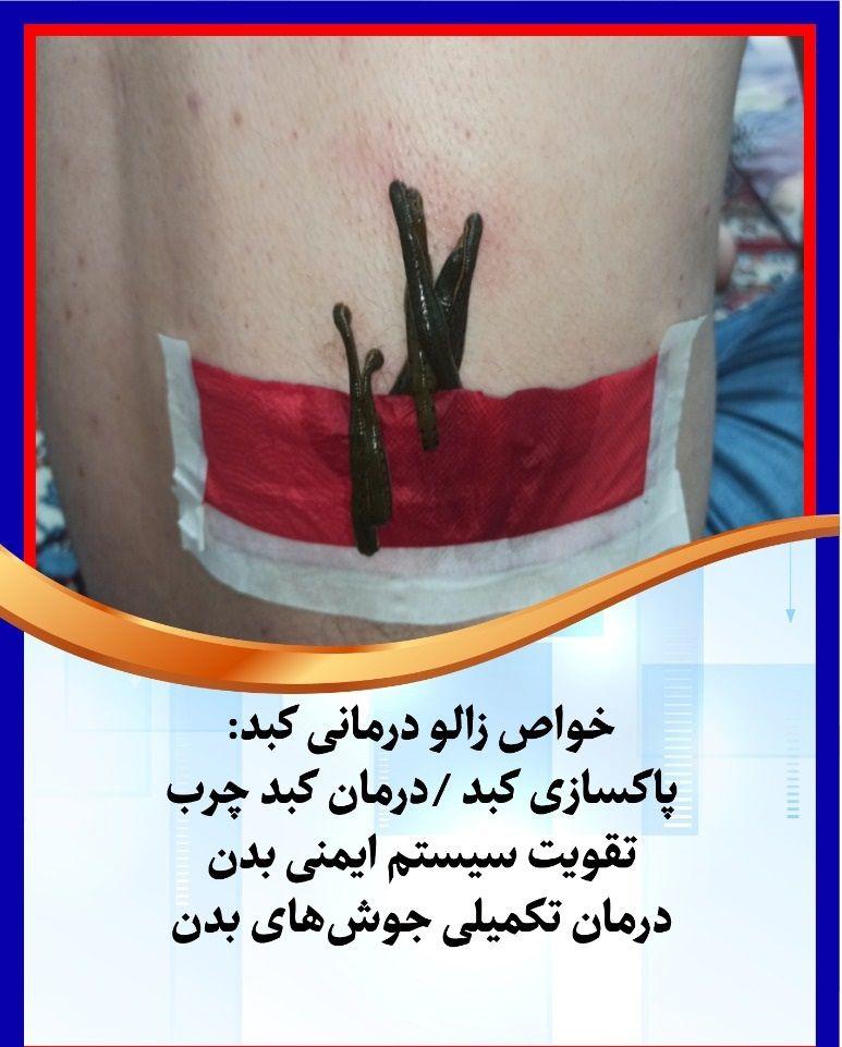 ماساژ.حجامت.زالودرمانی مظلومی