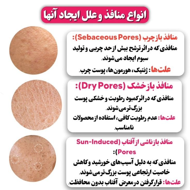 محصولات مراقبتی،زیبایی پوست وموتراست