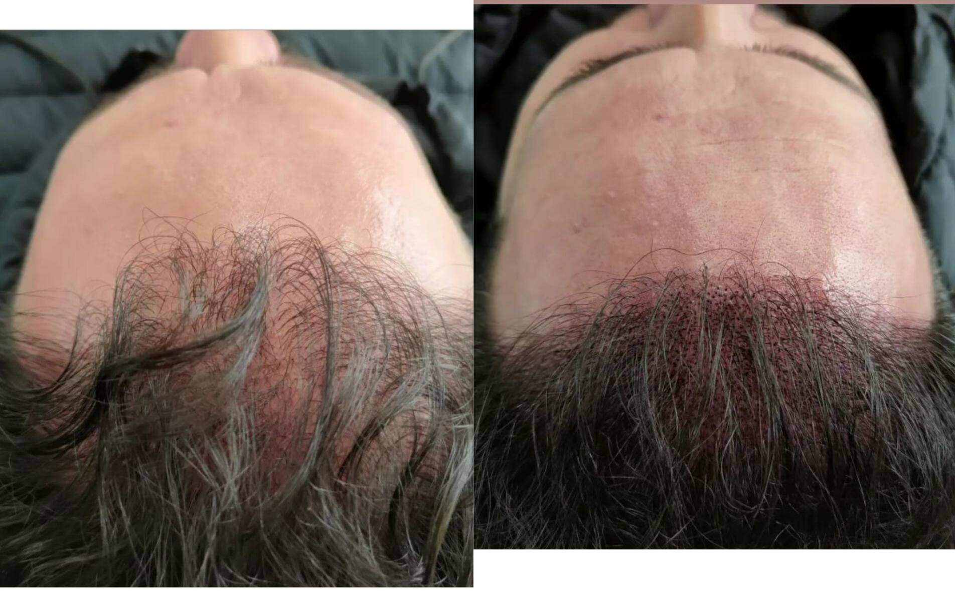 مرکز تخصصی میکرو اسکالپ