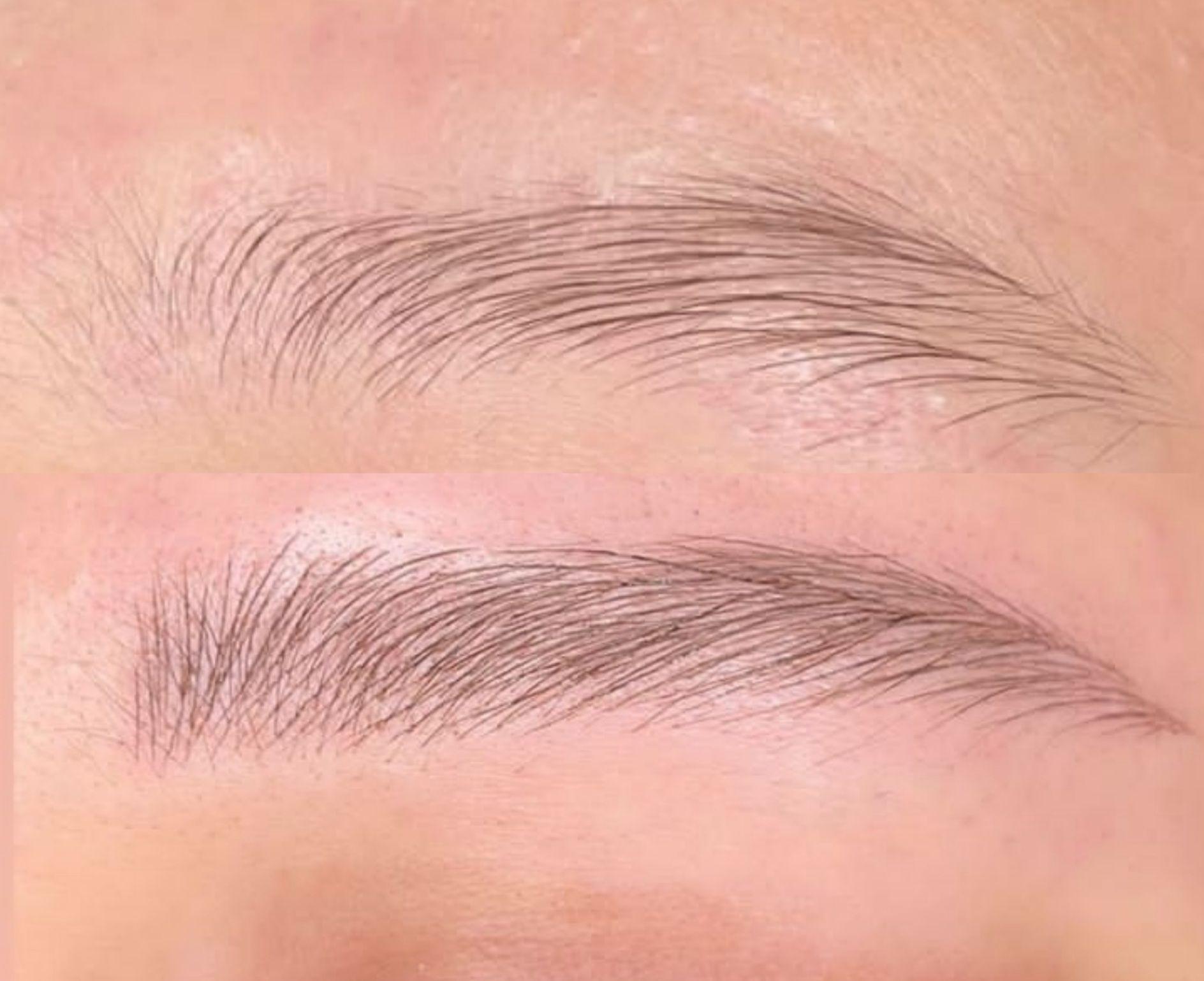 مرکز تخصصی میکروبلیدینگ فیبروز ابرو