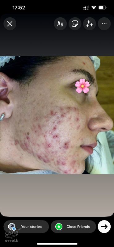 مرکز تخصصی پوست خانه ی امید