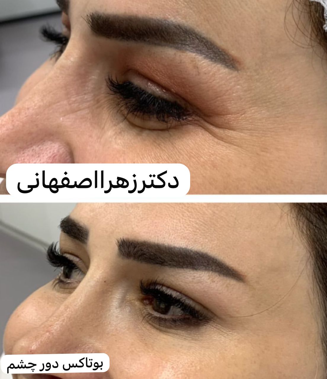 مرکز تخصصی پوست مو دکتر زهرا اصفهانی