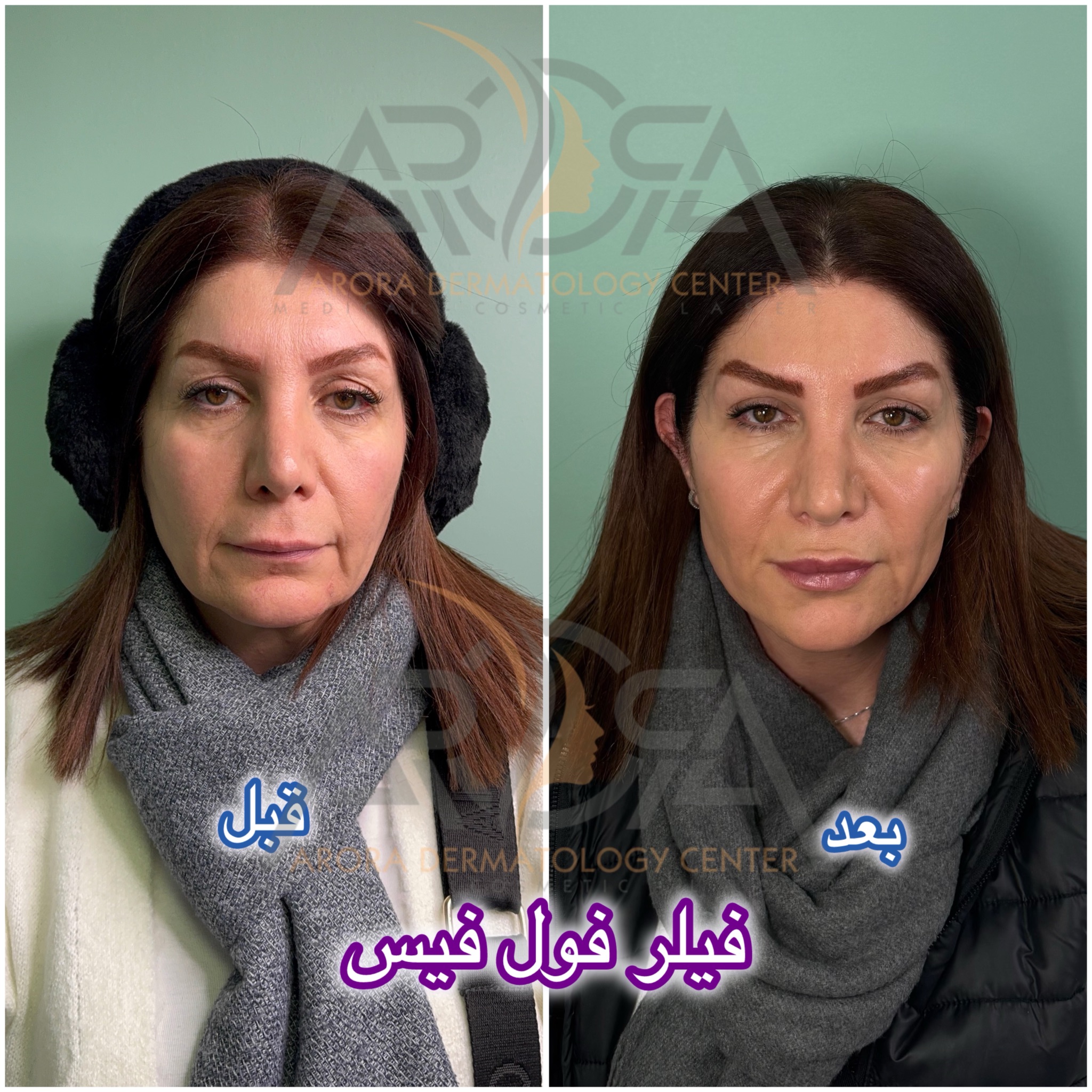 مرکز لیزر و زیبایی آرورا