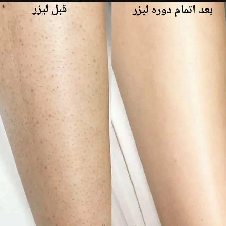 مرکز لیزر یاس