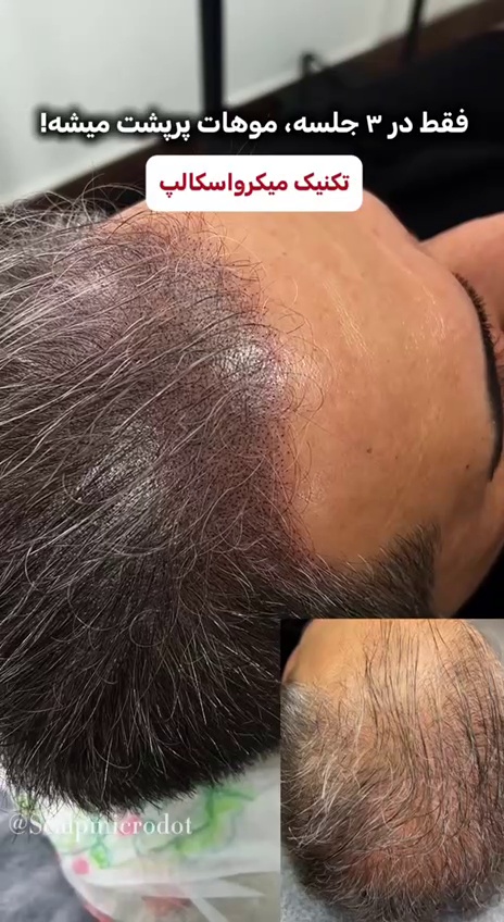 مرکز میکرواسکالپ عطار