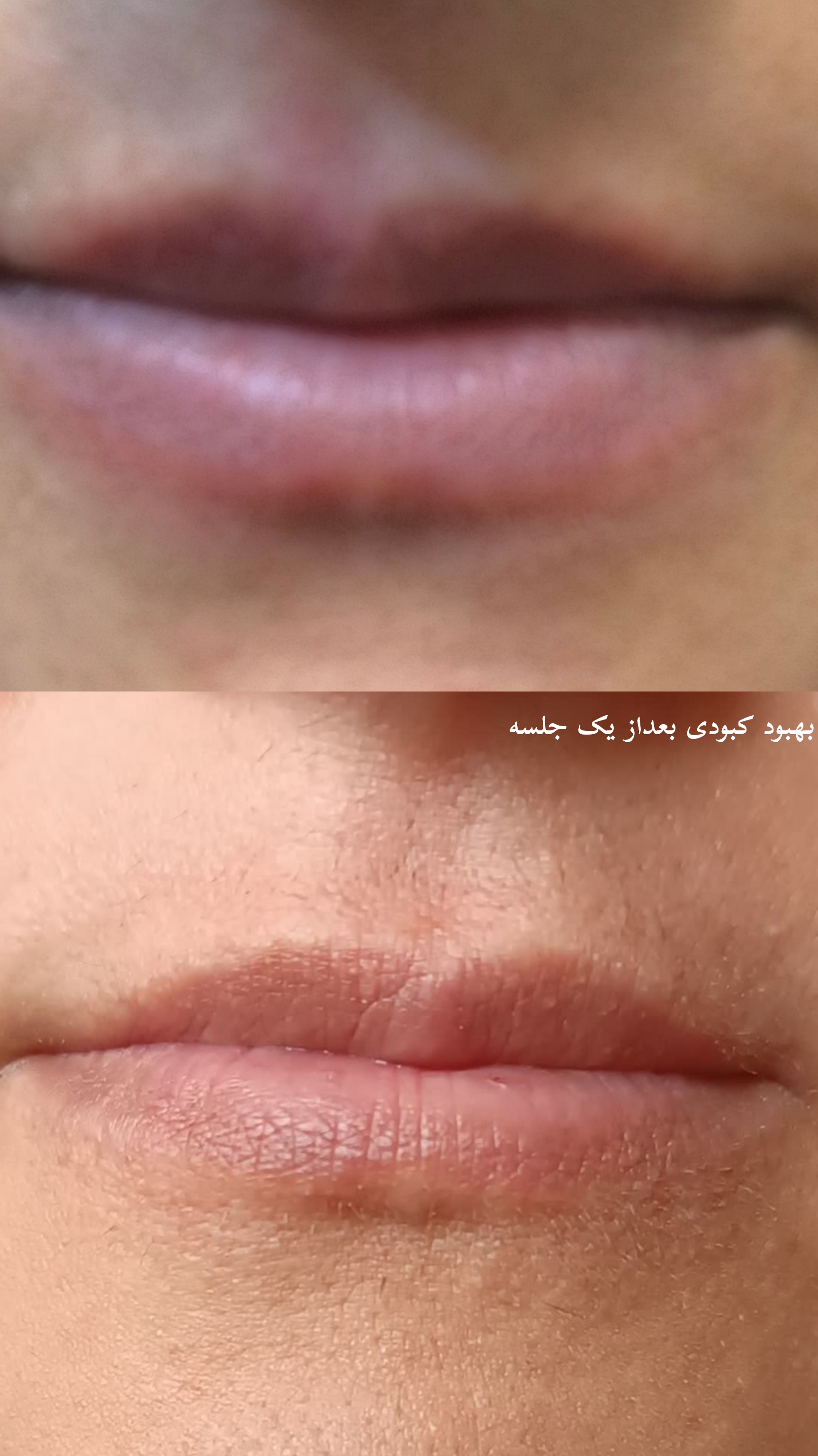 مرکز میکروبلیدینگ تخصصی(صادقی)