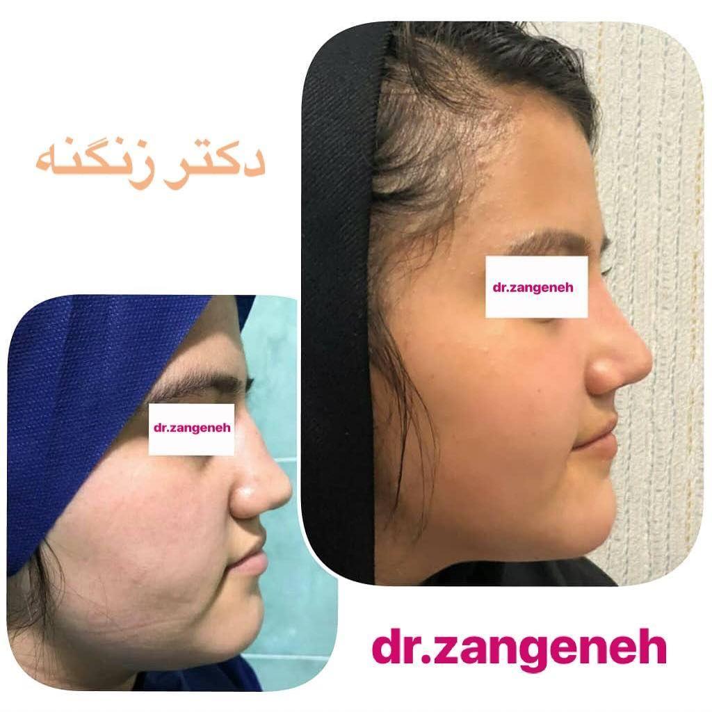 مطب جراح زیبایی دکتر حمیدرضا زنگنه