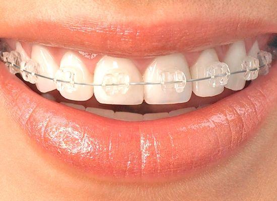 مطب دندانپزشکی خانم دکتر فاطره صمدی