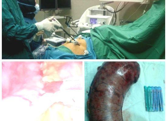 مطب دکتر هاشمی زاده فوق تخصص جراحی لاپاراسکوپی
