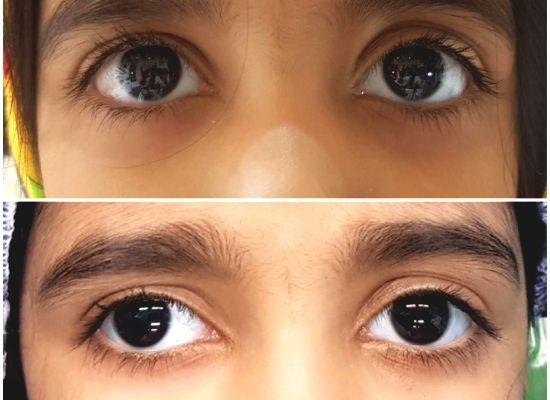 مطب چشم پزشکی دکتر مرجان اکبری کامرانی
