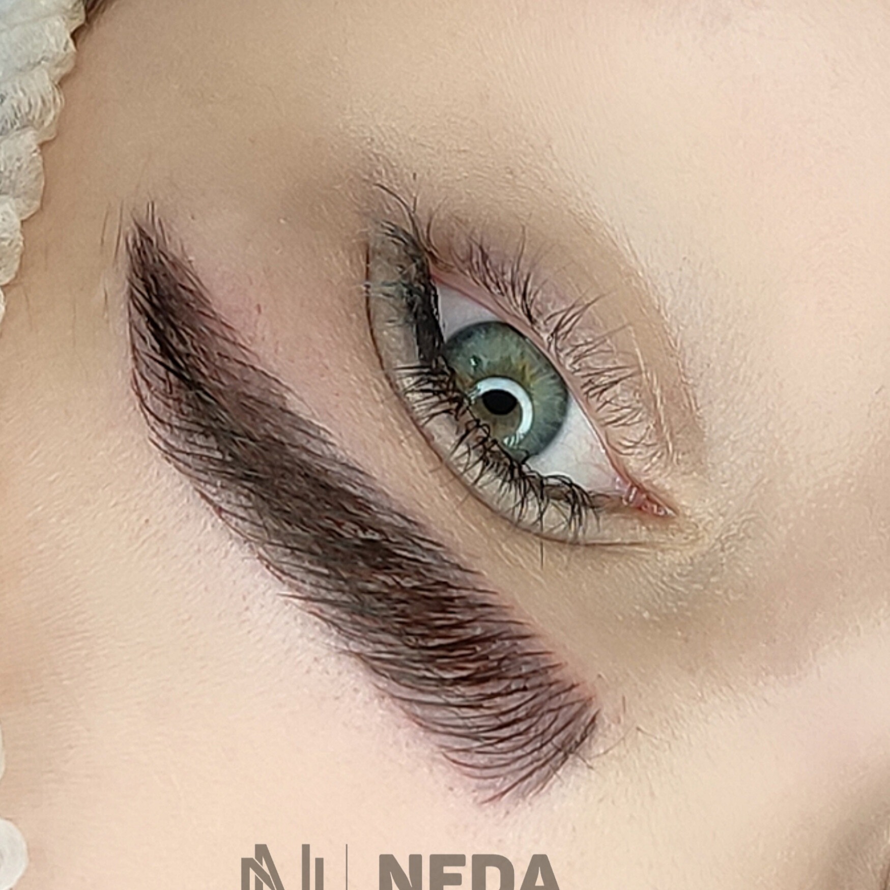 میکرو، شیدینگ لب ریموو تتو میکرواسکالپ ندا