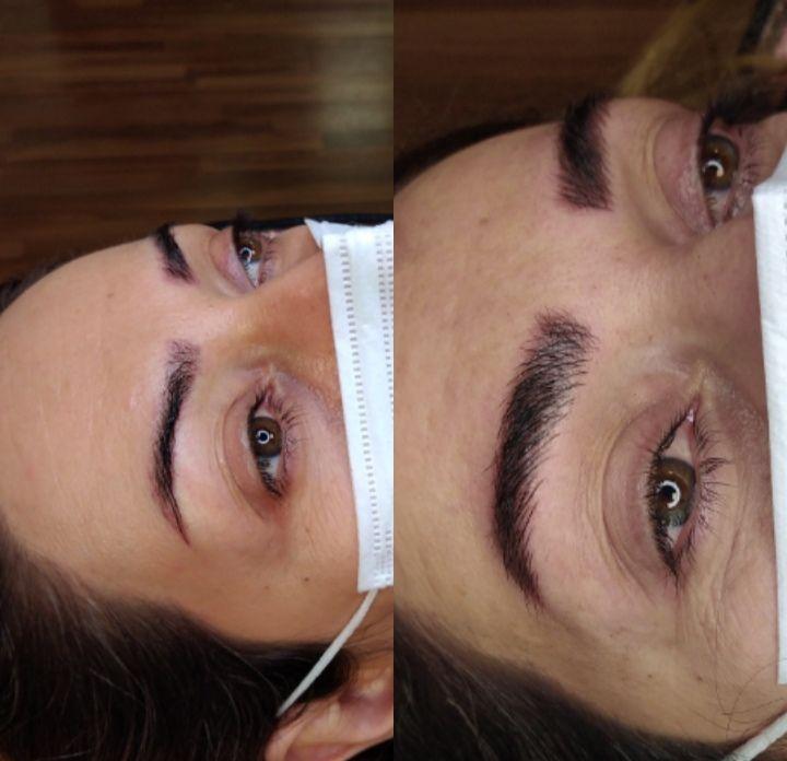 میکروبلیدینگ تخصصی ابرو