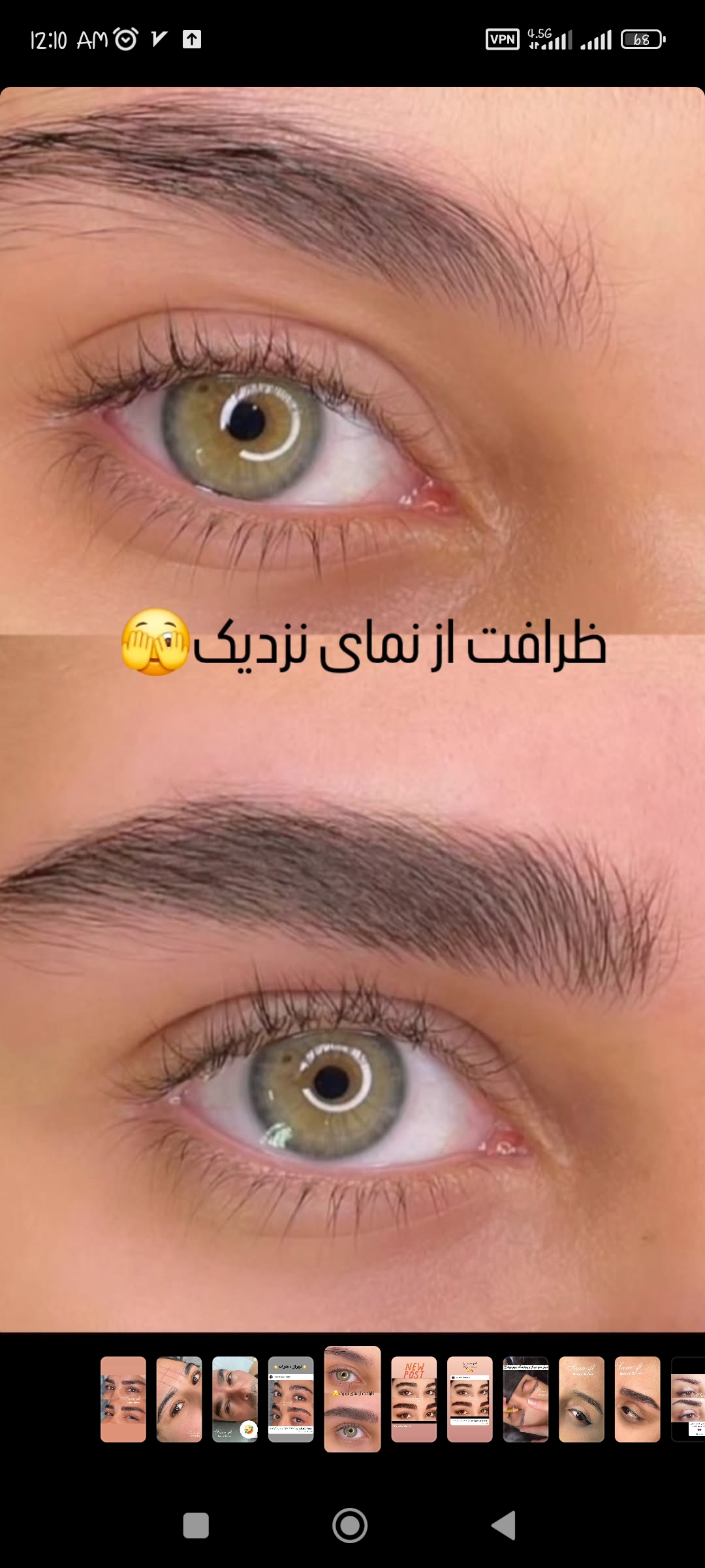 میکروبلیدینگ سارا
