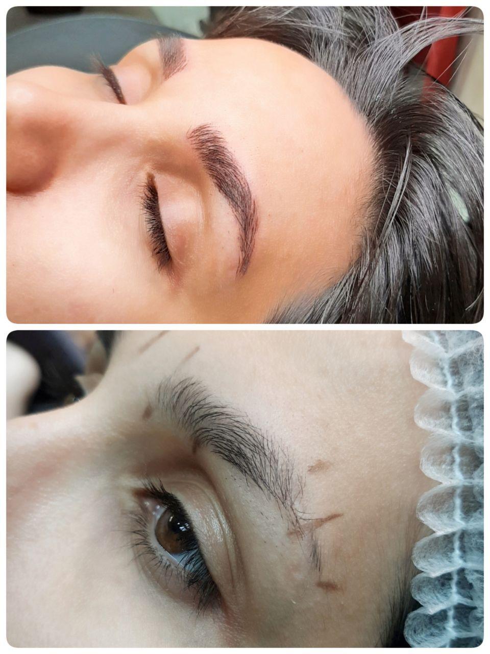 میکروبلیدینگ مهشید