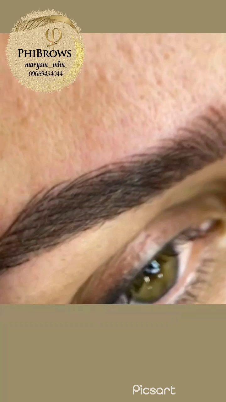 میکروبلیدینگ و میکروپیگمنتیشن مریم