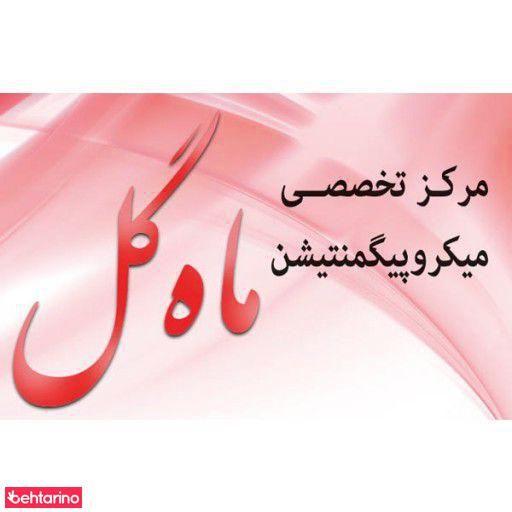 میکروپیگمنتشن ماه گل