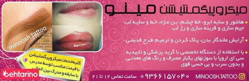 میکروپیگمنتیشن مینو
