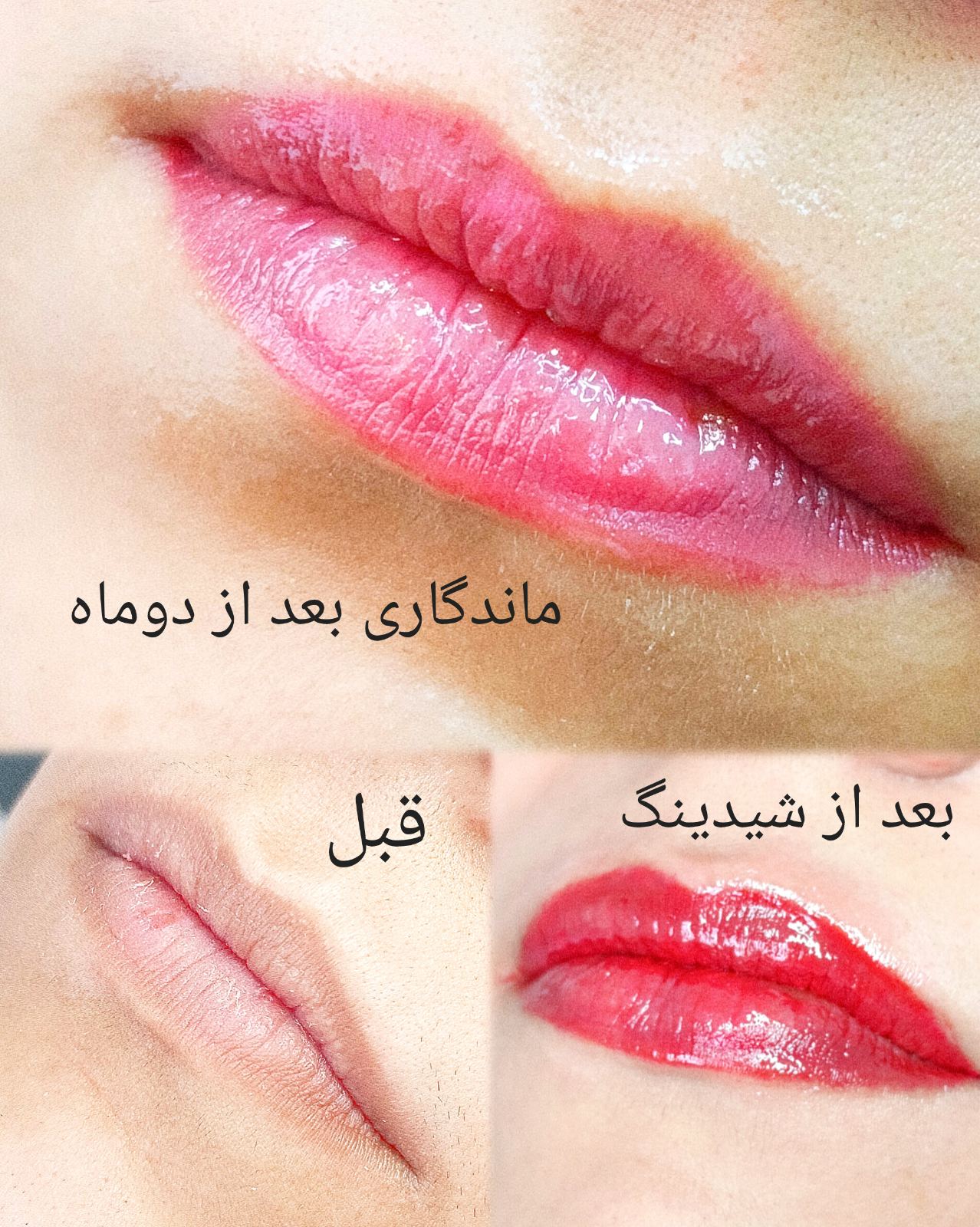 میکروکاروتاتوآرتیست عاطفه مقدم