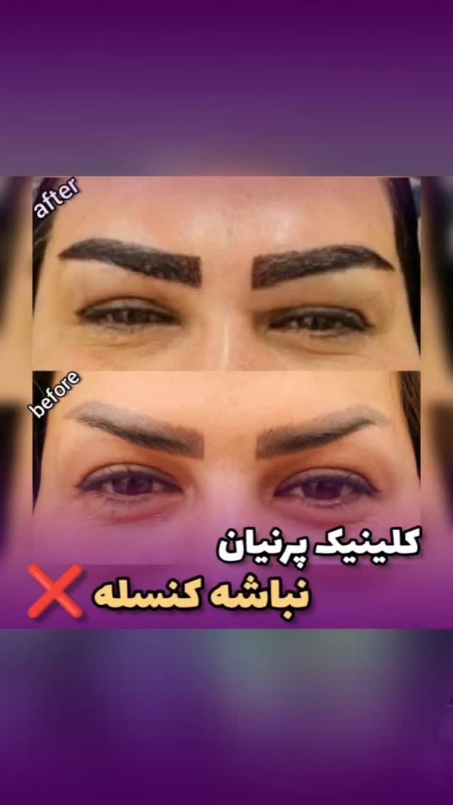 کلینیک تخصصی پوست و مو و لیزر پرنیان