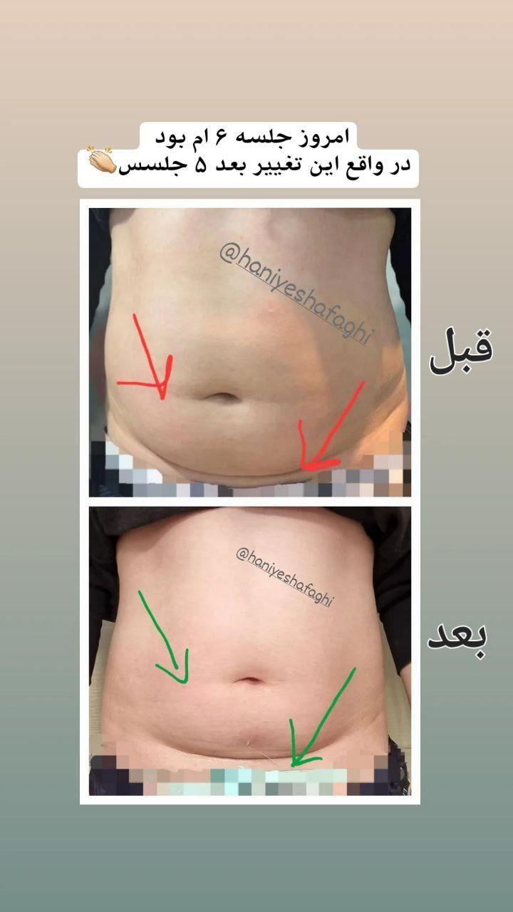 کلینیک تغذیه و رژیم درمانی امگا