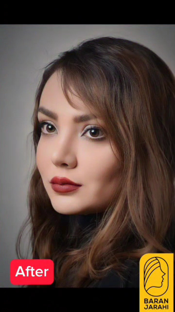 کلینیک زیبایی باران جراحی