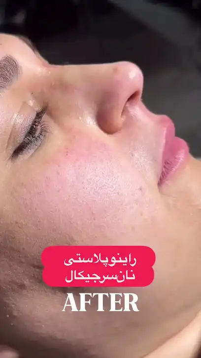 کلینیک زیبایی دکتر قزلباش کرمانشاه