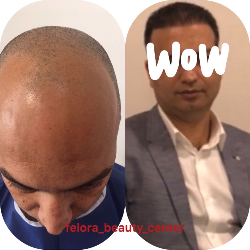 کلینیک فلورا بیوتی
