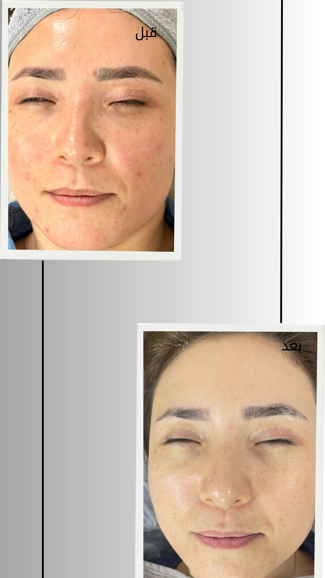 کلینیک فیشیال و پاکسازی پوست صبا