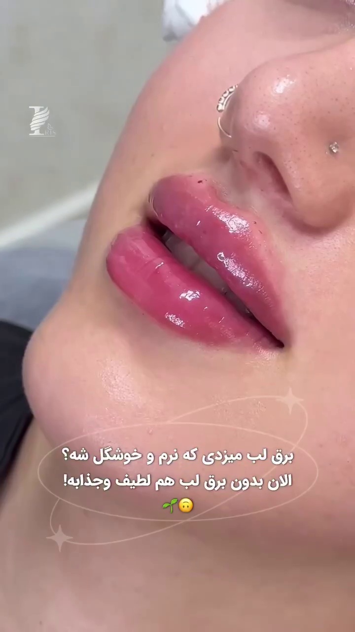 کلینیک لیزر و زیبایی آیریس