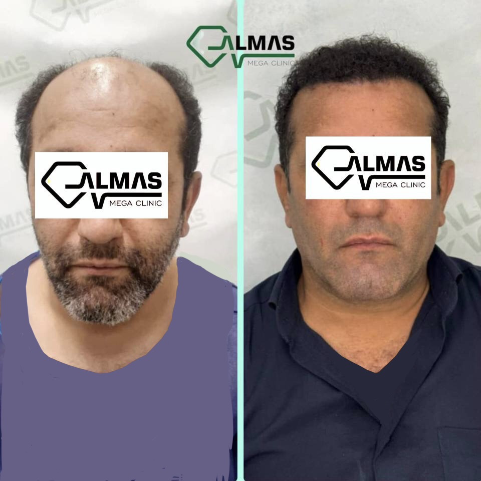 کلینیک پوست،زیبایی ولیزر وکاشت مو الماس
